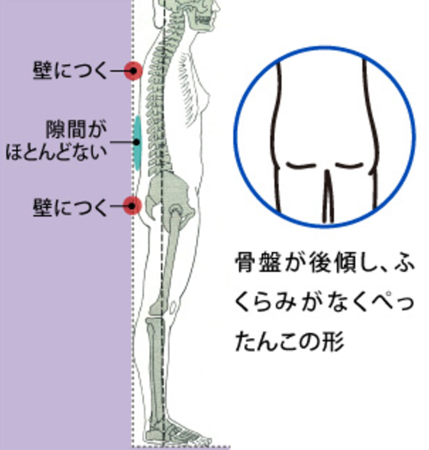 post
